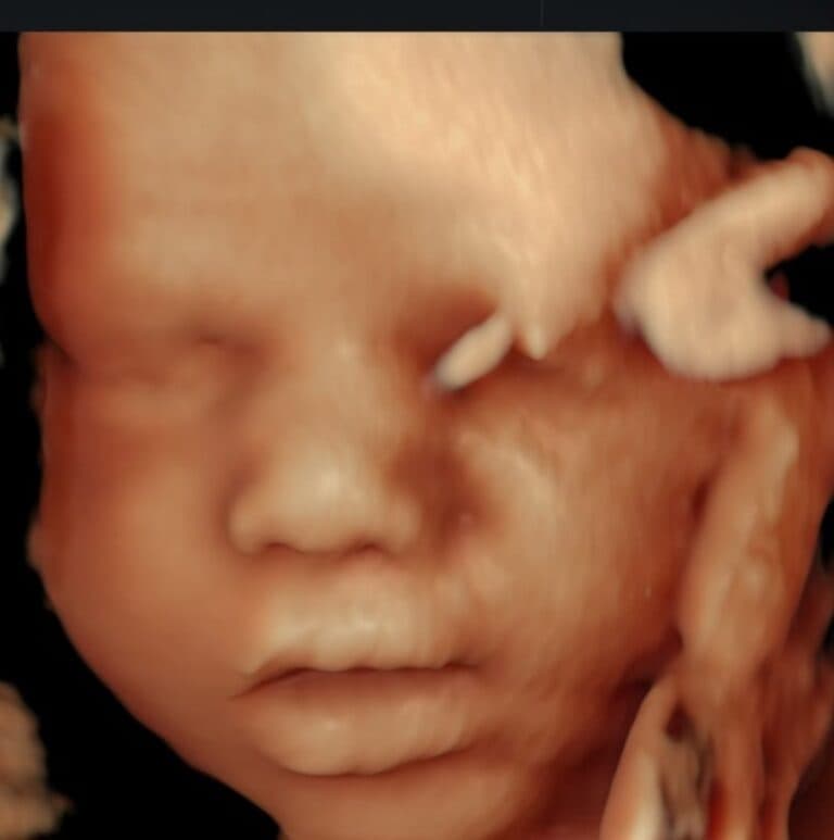 Video Prenatal Mommy Bundle