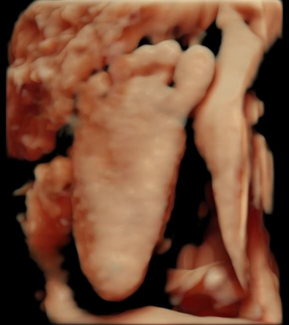 4D ultrasound close-up of baby's foot and toes