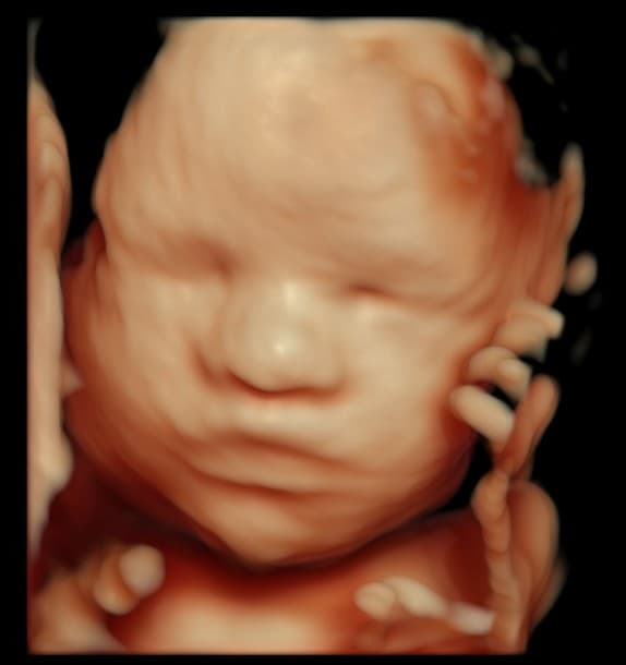 5D HD ultrasound of baby with hand near cheek, side view
