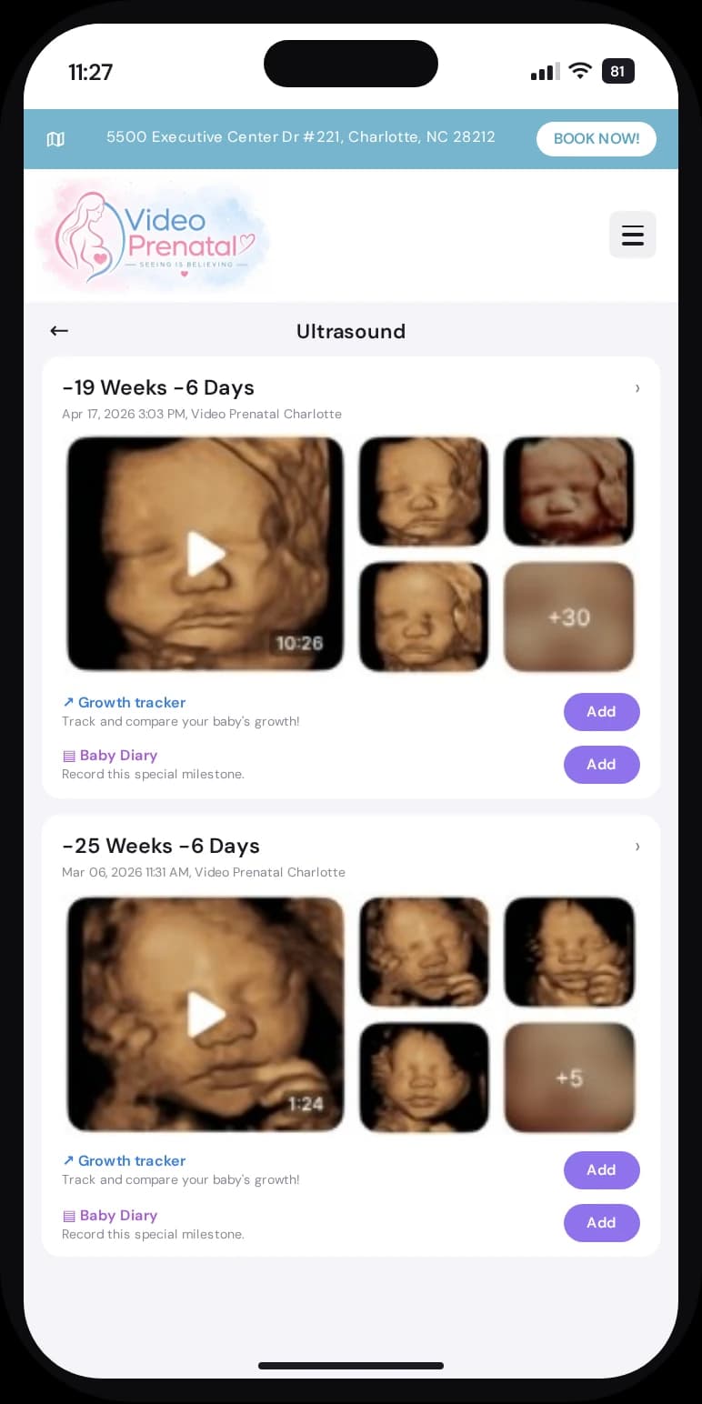 Bomee app showing ultrasound images and videos