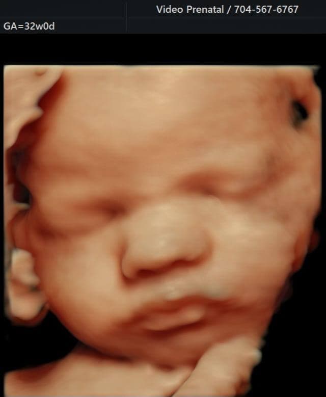 Video Prenatal Golden Memories